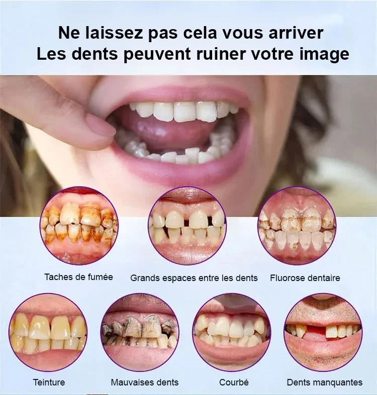Souriez à Nouveau en Toute Confiance – Prothèse Dentaire Custom‑Fit