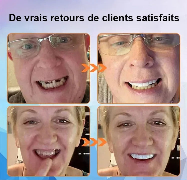 Souriez à Nouveau en Toute Confiance – Prothèse Dentaire Custom‑Fit