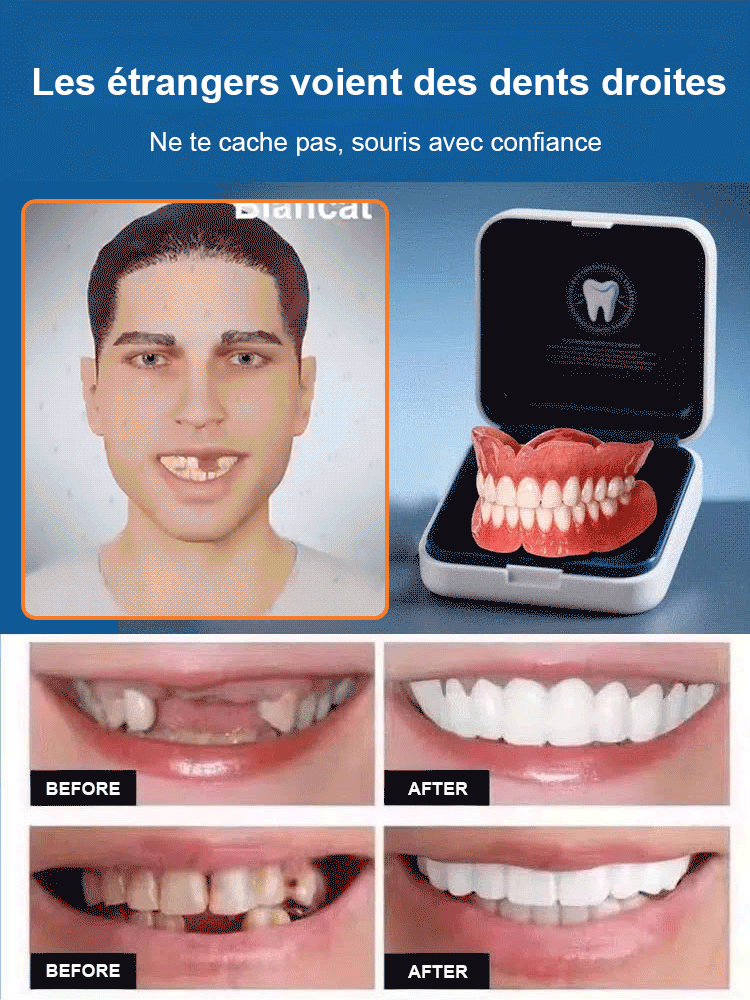 Souriez à Nouveau en Toute Confiance – Prothèse Dentaire Custom‑Fit